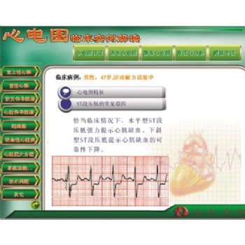 新版心电图教学软件心电图临床实例解读